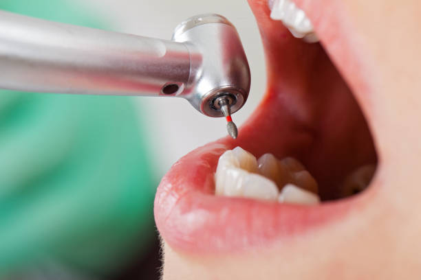 Best Broken or Cracked Tooth Emergency Dentist in Macarthur, WV